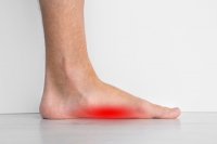 Pain or No Pain With Flat Feet
