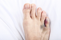 Understanding the Causes of Pinky Toe Pain