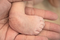 An Overview of Clubfoot