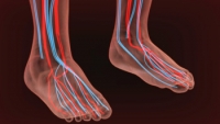 Dangers of Blood Clots in Your Foot